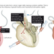Illustration for article titled How Well Finally Put An End To Organ Donation Shortages